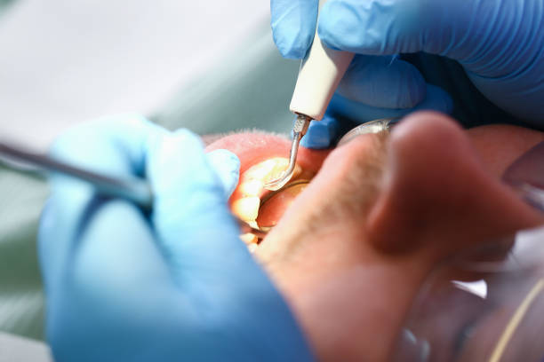 Best Urgent Dental Care for Toothaches in Coson, OK