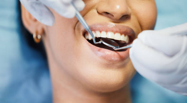Best Emergency Cosmetic Dentistry (e.g., broken veneers) in Coson, OK