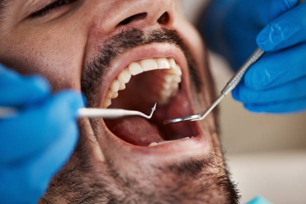 Best Emergency Dental Care for Sports Injuries in Coson, OK