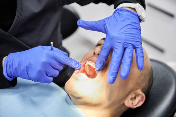 Best Emergency Treatment for Oral Infections in Coson, OK